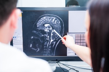 Doctor Looking at a Brain Scan After an Injury
