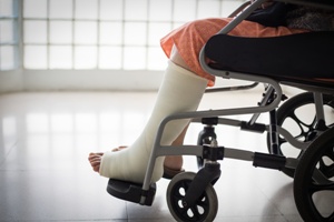 woman in wheelchair with leg cast